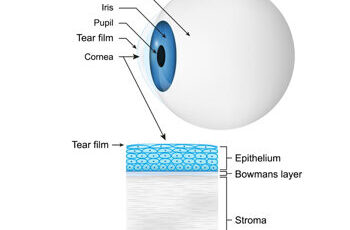 Hornhautendothel-Transplantation